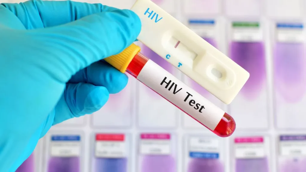 HIV test